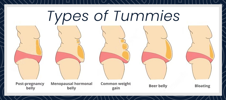 How Long Do Tummy Tuck Results Last?