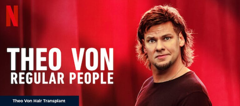 Theo Von Hair Transplant - Smile Hair Clinic