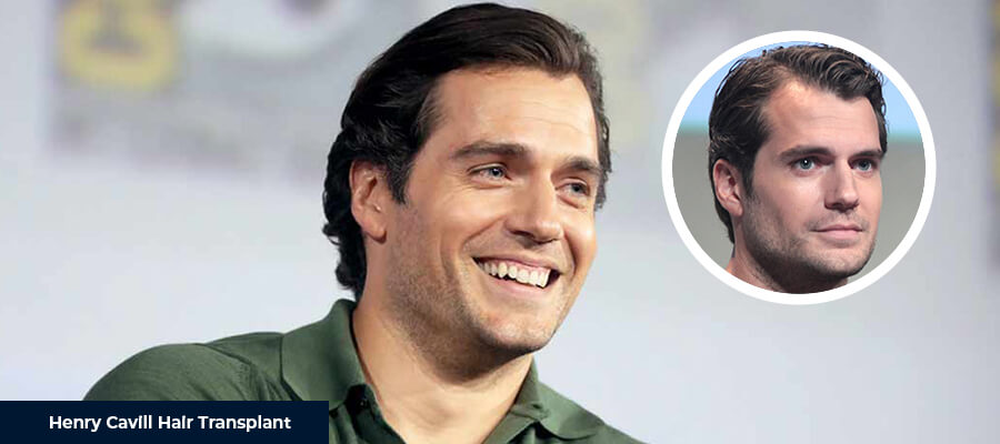 Henry Cavill Before And After